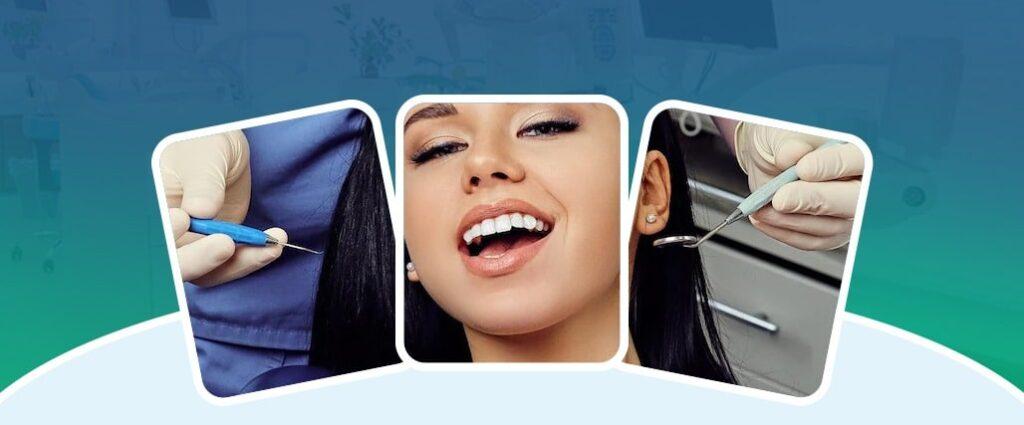 dental implants in guntur