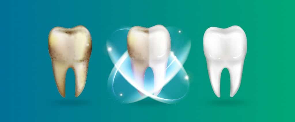 dhruthi-healthcare-Good-&-Bad-Food-For-Your-Oral-Health